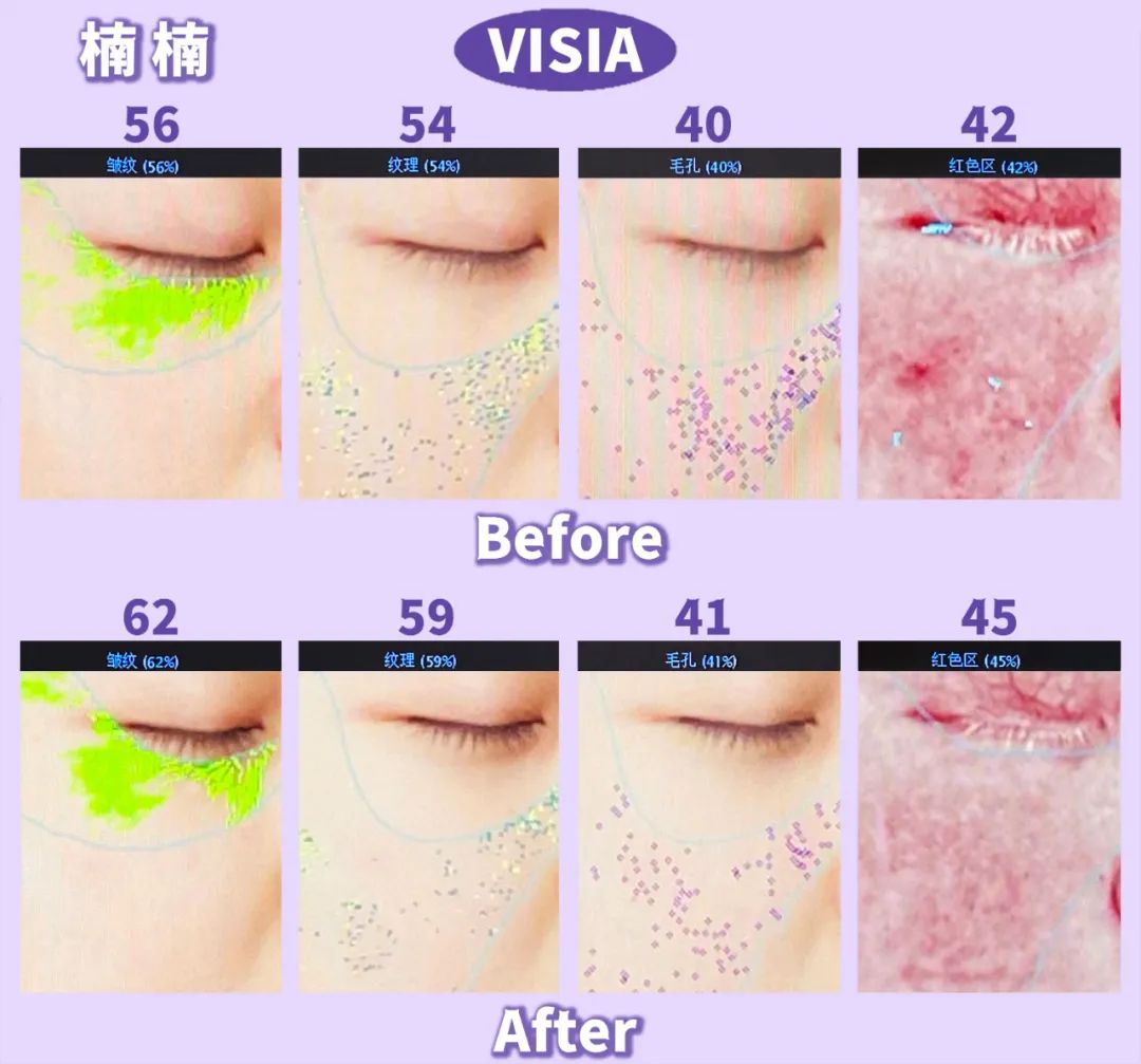 美肌抗老,城野医生169抗老精华测评