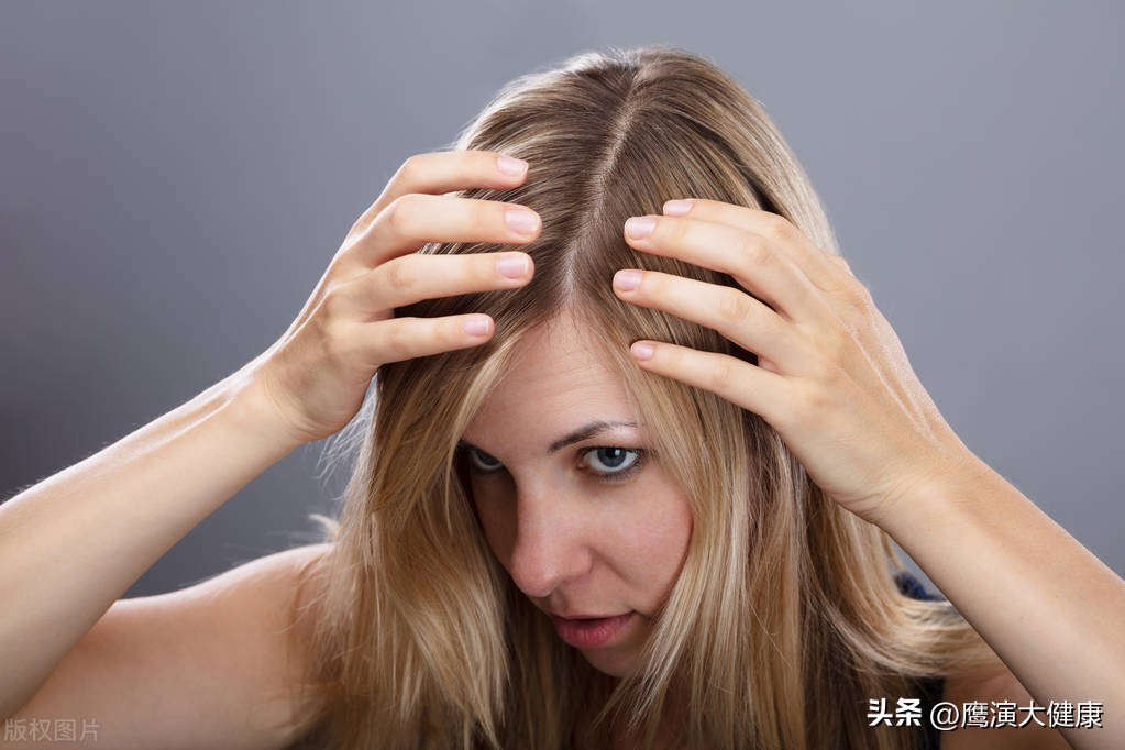 头皮上抠下来的白泥是螨虫吗,头皮上抠下来白泥是什么