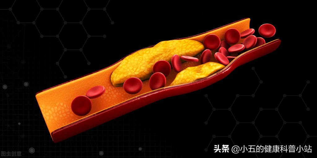 人老腿先衰8个表现预示你已衰老,人老腿先老的三种表现