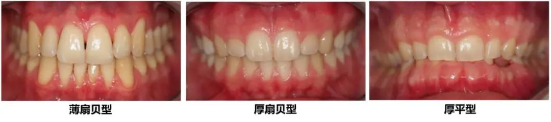 怎么拯救脱发小仙女,如何拯救牙齿上的黑洞