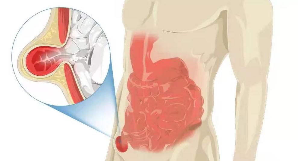 人体最鸡肋的器官,人体最不靠谱的器官