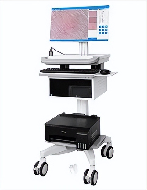 谈痣色变,身上长的痣都是色素痣吗