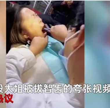 女子拔智齿被摇晃1小时,女子拔智齿医生硬拉摇晃一小时