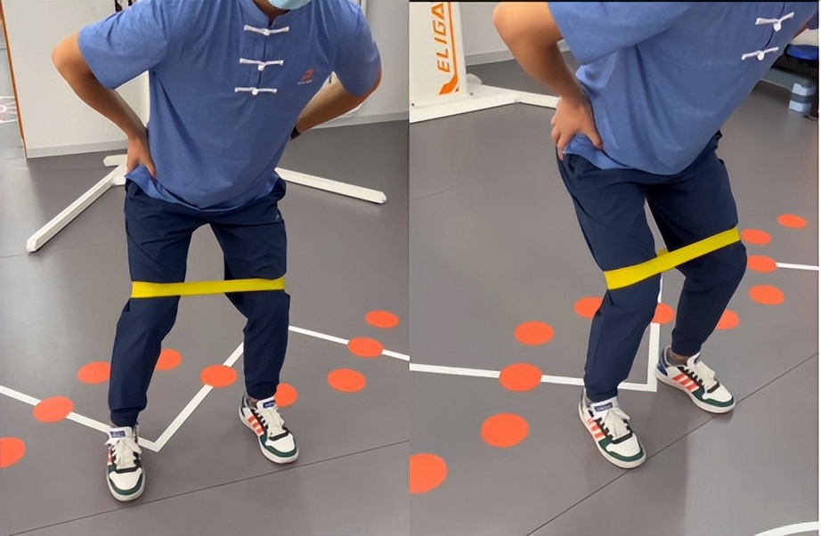 脊柱侧弯有失败的案例吗,脊柱侧弯今日案例分享