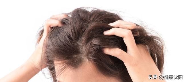 专家告诉你头屑多怎么办,头屑带来的烦恼是什么