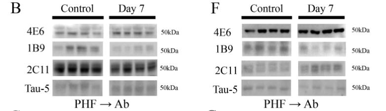 tau鎶椾綋,tau鎶椾綋涓村簥璇曢獙