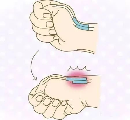 小针刀是什么东西,小针刀有什么神奇