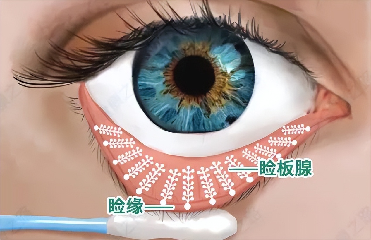 干眼症是什么绝症原版,干眼症是绝症么