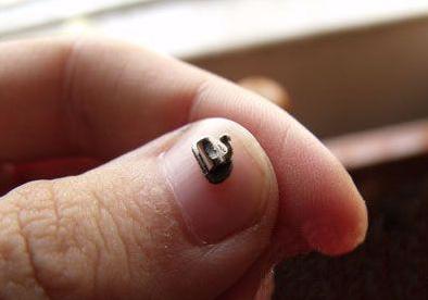 明明很小心，为什么托槽还是老掉？专家分析：问题出在这