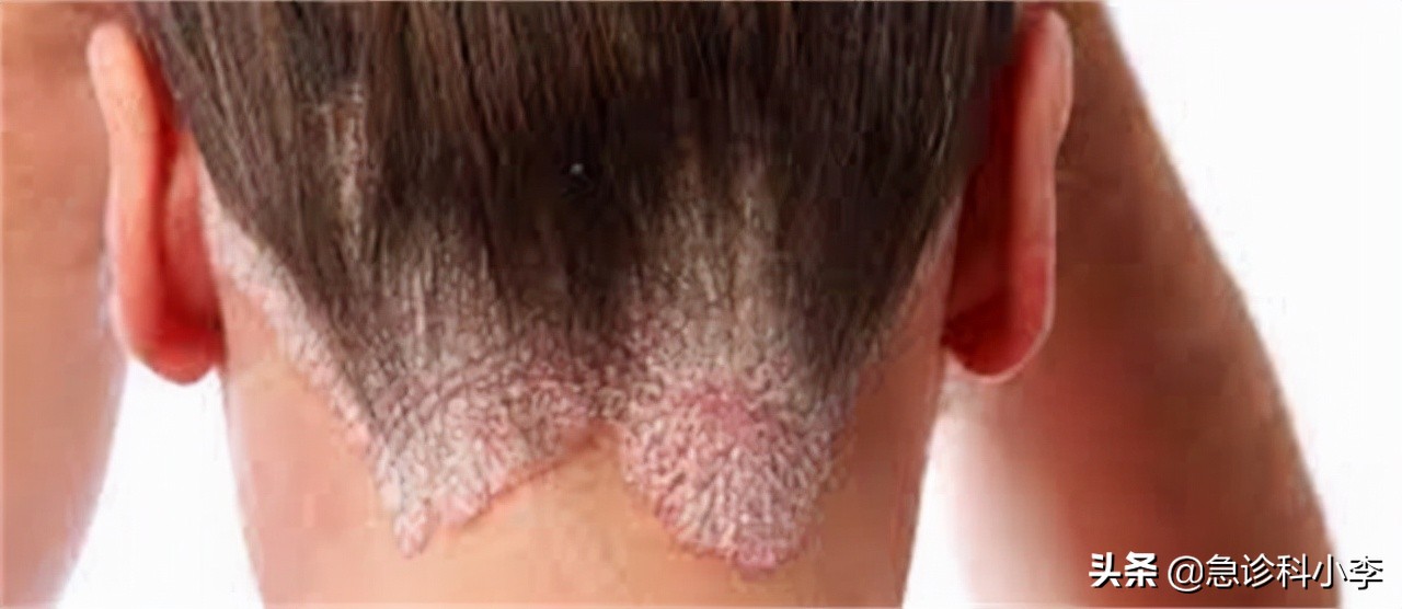 5种常见的疾病目前无法根治，千万别被忽悠了