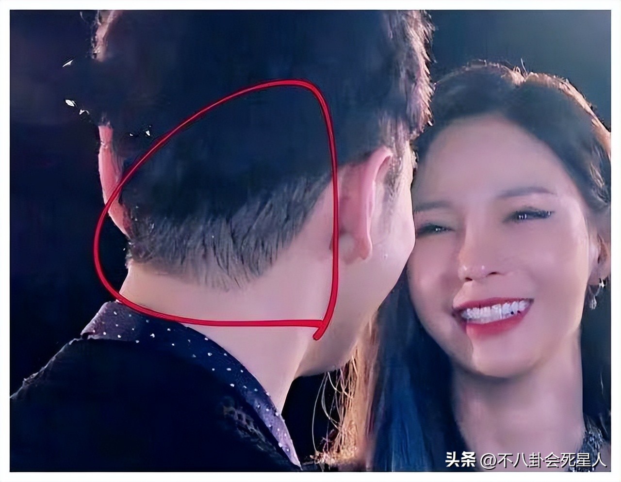 杨幂用的生发液长出了头发,杨幂说怎么治疗脱发