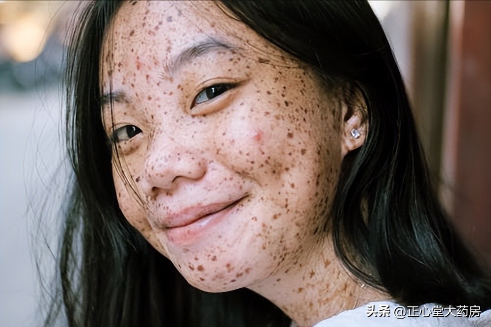 鼻子脸颊容易出油怎么护肤,鼻子老是爱出油用什么护肤