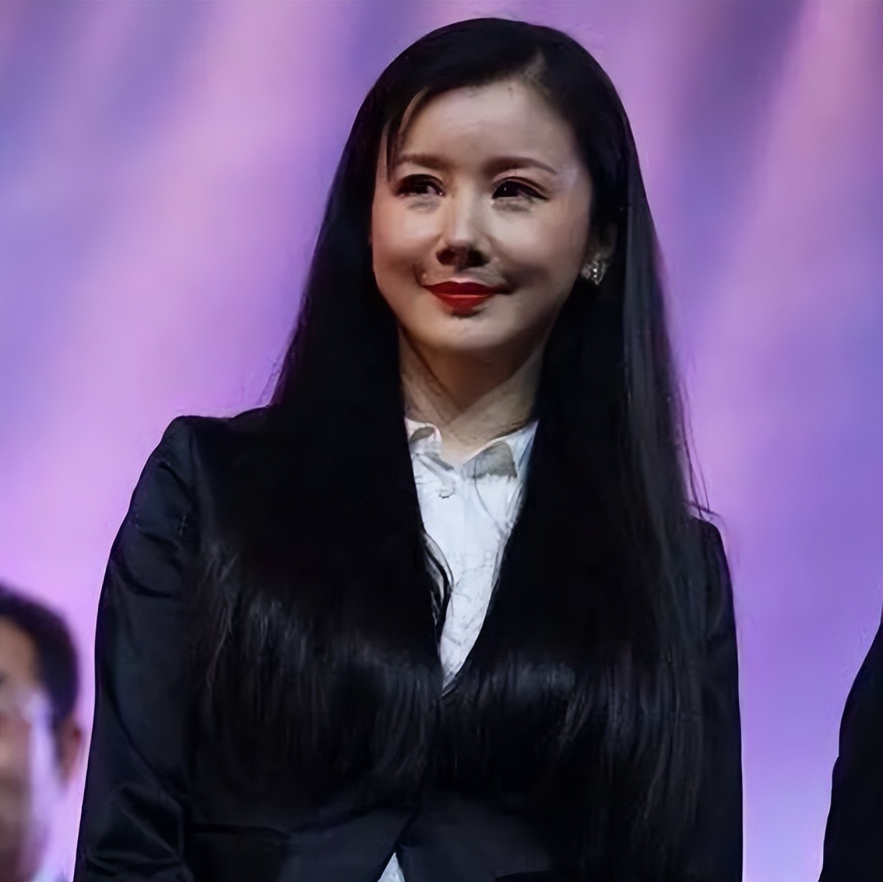 明星下颚骨整容后遗症,脸像鞋拔子怎么改善