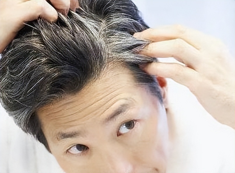 白头发变黑发需要怎么补充营养素,白头发要补什么营养素最好