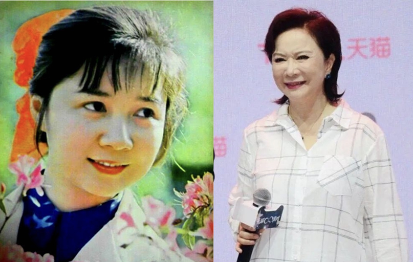 老演员整容脸变形,老年人整容前后照片