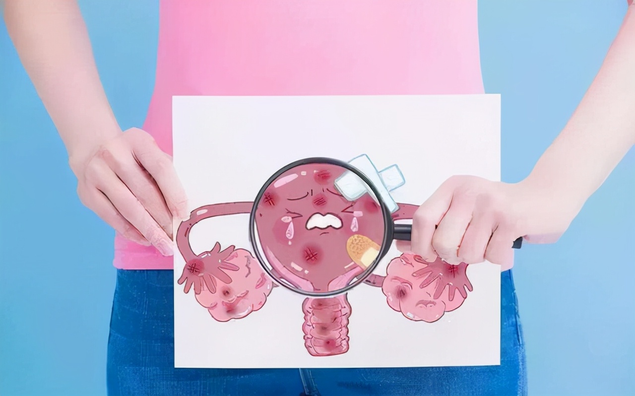 宫颈癌是“拖”出来的？医生提醒：出现这3个症状，趁早就医