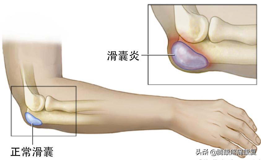 女性左侧软组织疼痛,常见疼痛类型有哪些特点