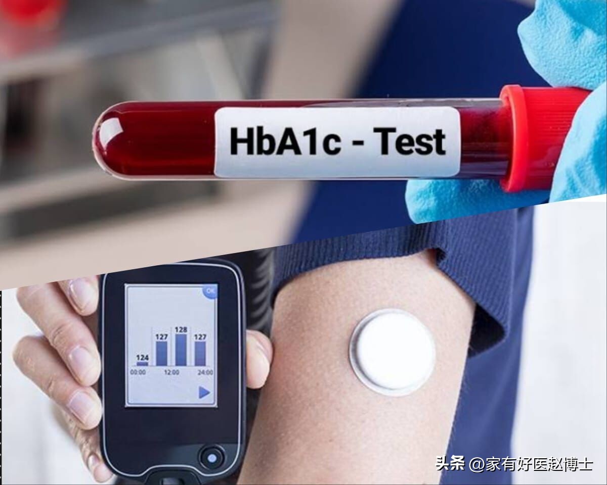 糖尿病严不严重看糖化,糖尿病真正的逆转是什么样的表现