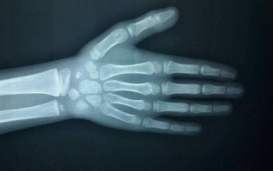 身高能长到几岁？16岁、18岁还是23岁？1年要长几公分才好？