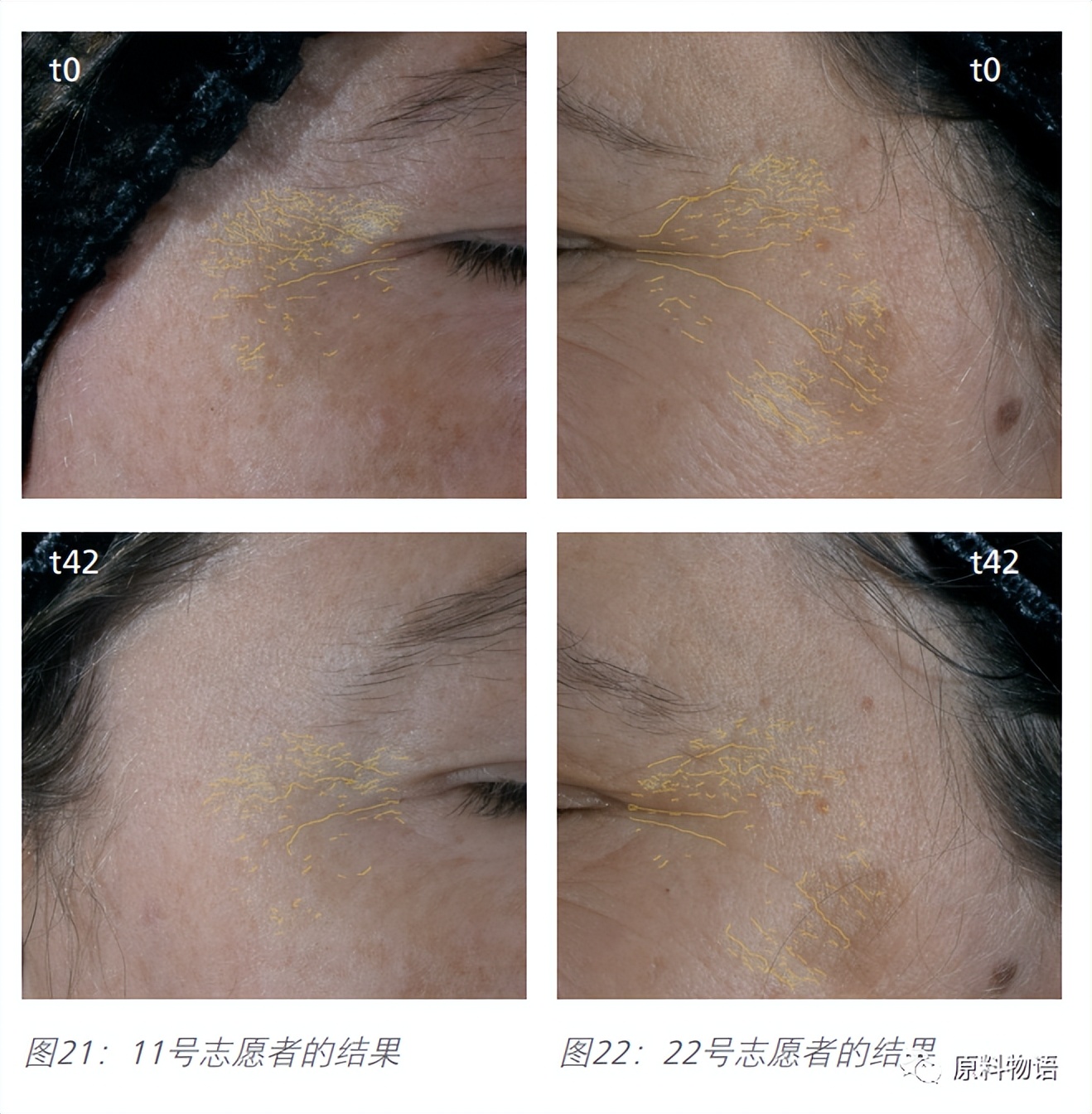 热门抗老概念一个原料就拉满？我们水乳露有二裂酵母