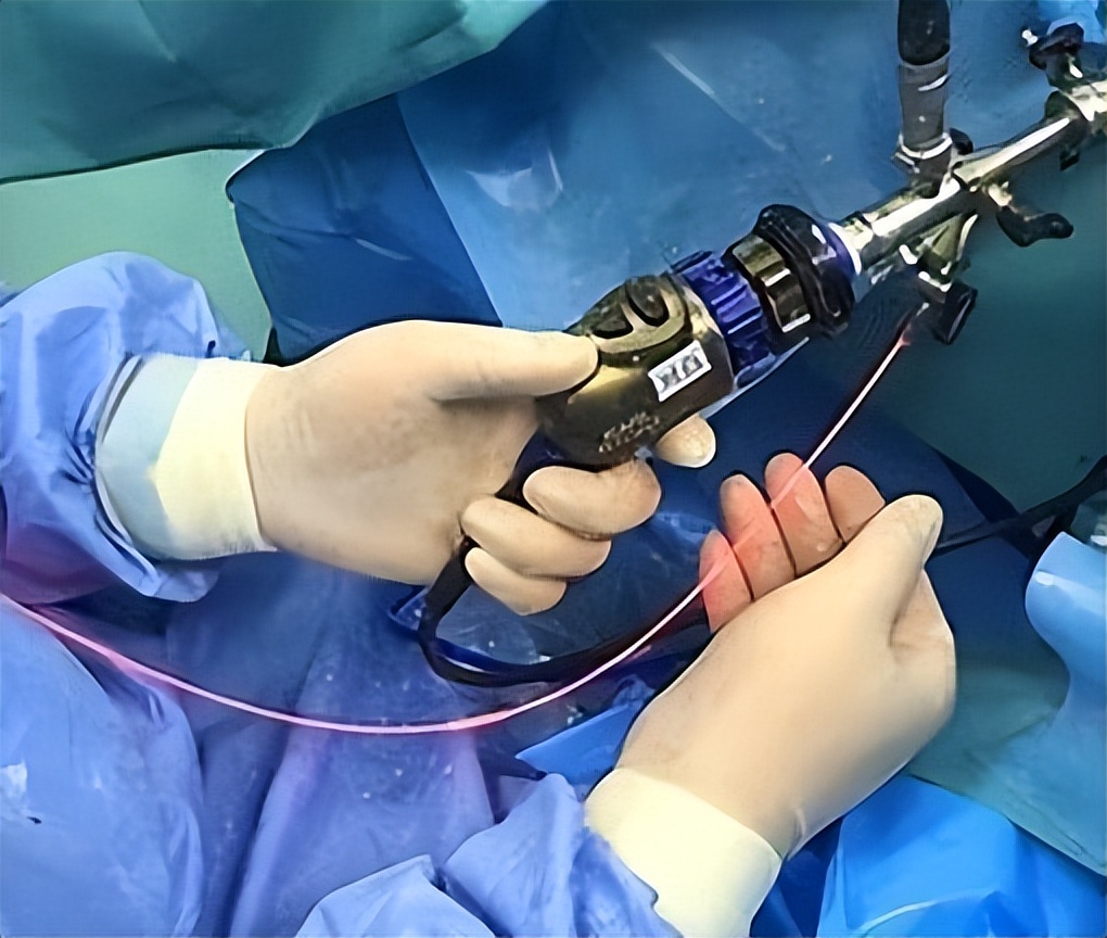 光动力治疗癌症是真的吗,光动力能治疗癌症吗