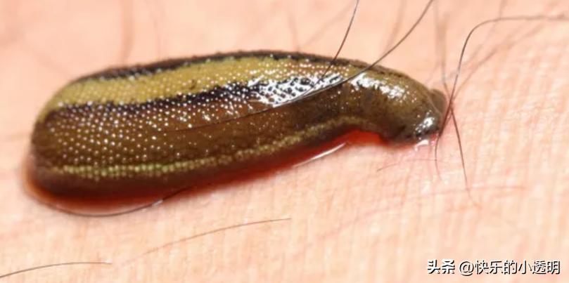 蚂蟥用活的吸血有什么危害,蚂蟥吃到肚子里有什么危险