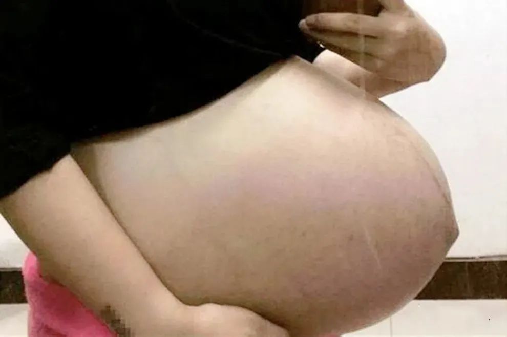 怀孕五个月了大肚子比小肚子大,怀孕五个月了肚子比别人大啥原因