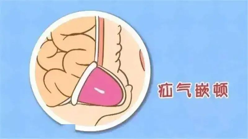 小男孩老是肚子痛怎么回事,男孩小肚子疼是小肠换气吗