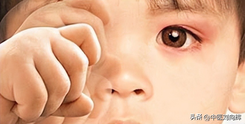 专家告诉你血虚的症状,血虚和血燥怎么判断