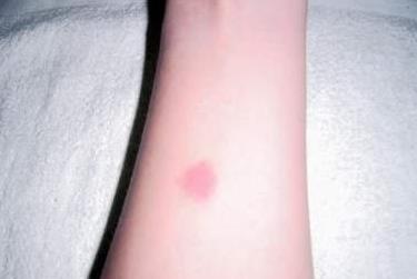 古人们是如何鉴别女子清白的,古代如何检查女子清白