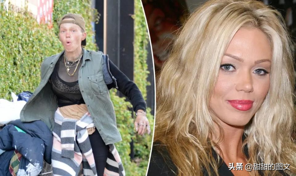 美国前名模街头捡食物吃，眼眶红肿手指瘀伤，无收入只能流浪