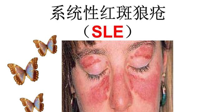 艾滋病有多难攻克,渐冻症艾滋病哪个更难治