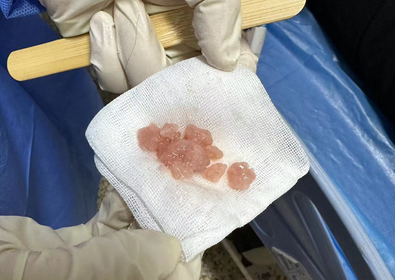 年糕变“黏”糕，险要老太命！