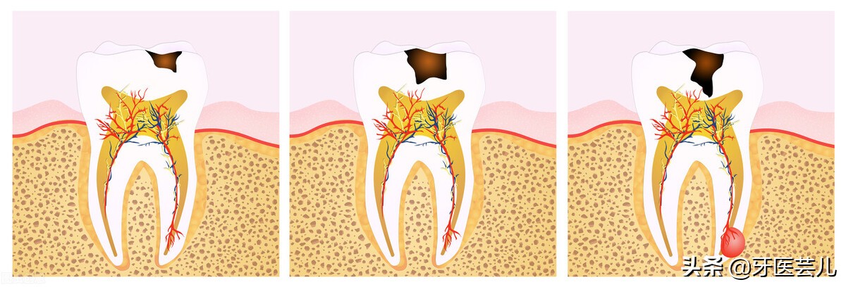 牙龈出血是找牙医还是找医生,牙龈出血是什么原因怎么治疗最快