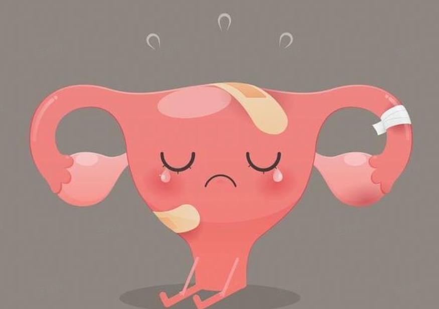 女性为什么容易长子宫肌瘤呢？医生：尽量避免3个行为，别忽视