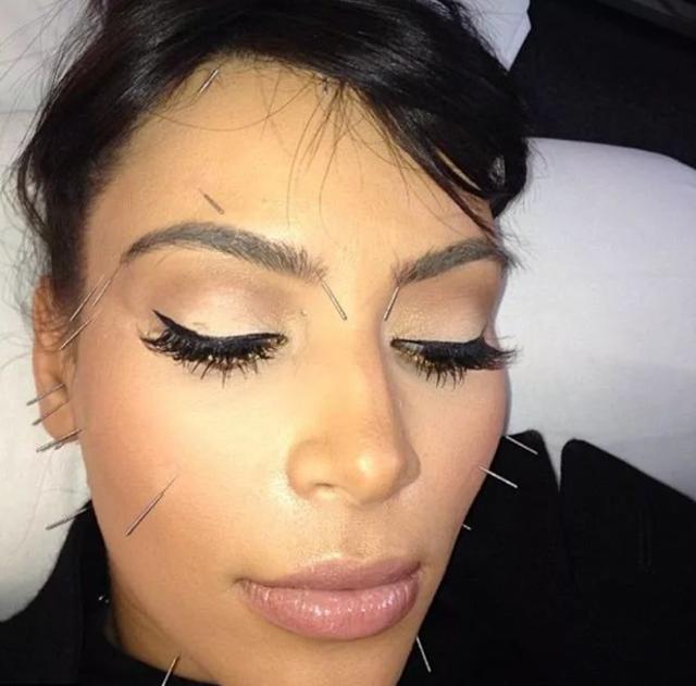 针灸被科学证实,针灸治疗是缓解还是能彻底治愈