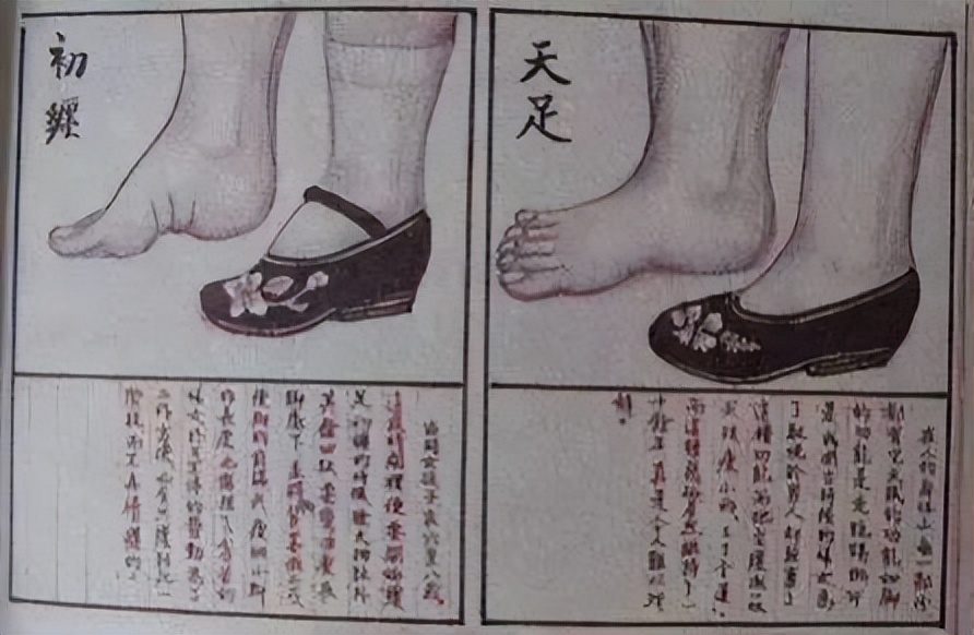 三寸金莲的悲惨生活,三寸金莲事件