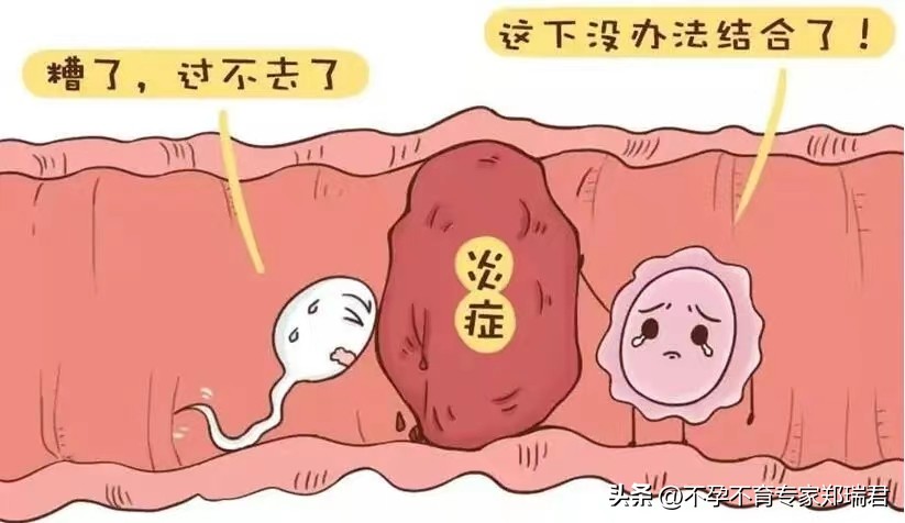 一侧输卵管不通能怀孕吗,输卵管一边通一边不通能怀孕吗