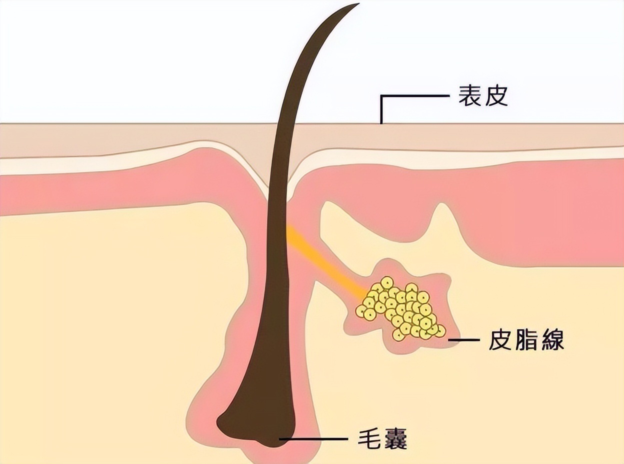 阴毛变白是身体生病了吗？