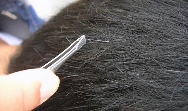 预防衰老身体具备哪些营养素,人体衰老的过程就是营养素流失