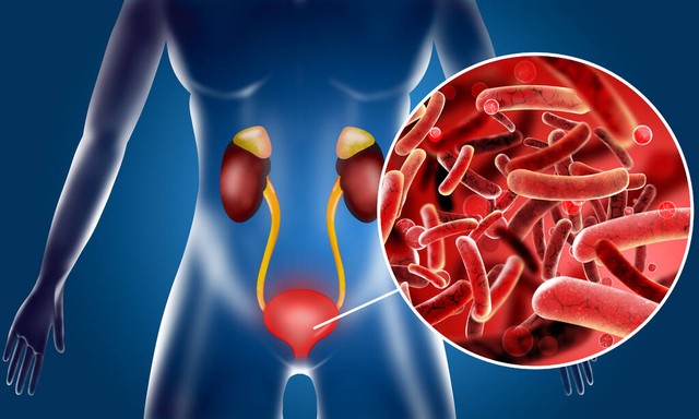 尿急尿痛的烦恼，如何调治