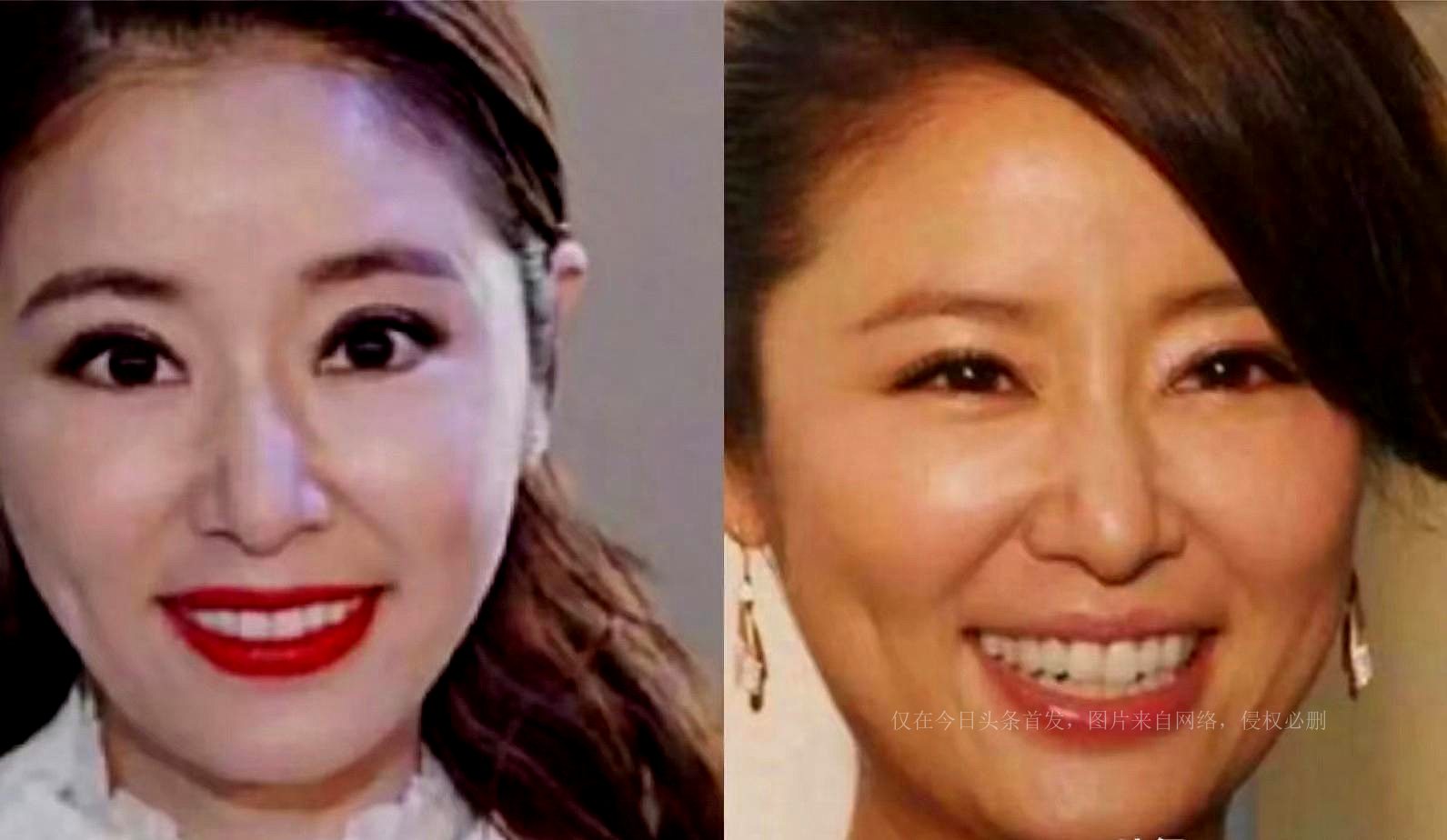 女明星捏鼻子把鼻子捏扁了,一脸科技的明星