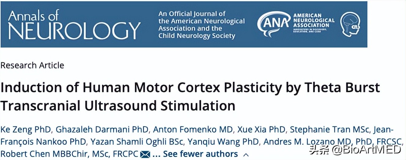 Theta-burst模式经颅超声刺激持续增强运动皮层兴奋性