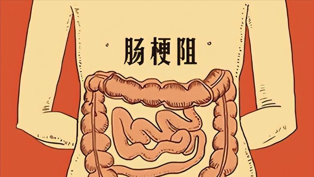 直肠癌的4个身体暗示需要警惕,直肠癌多半是拖出来的