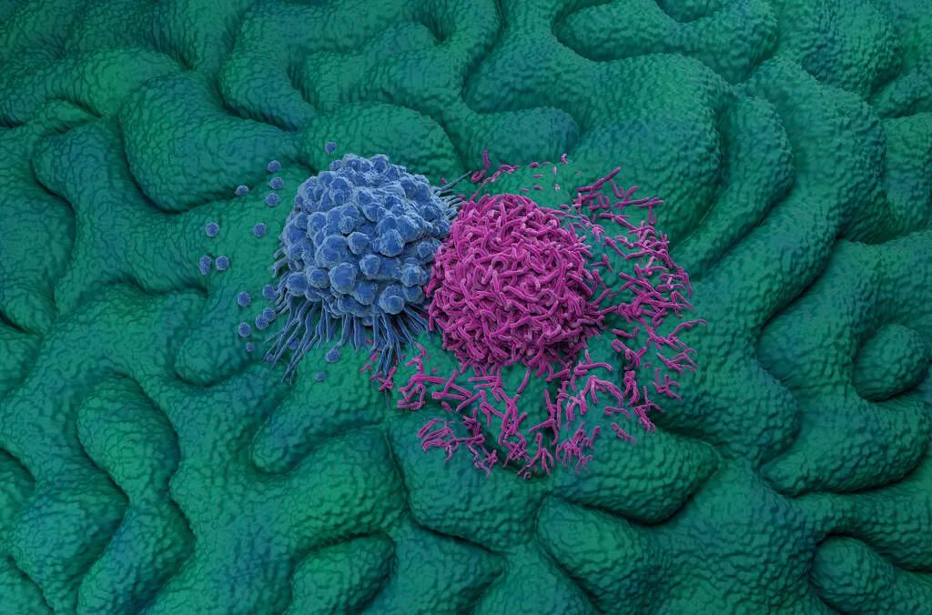 5种炎症易癌变,五种炎症不能致癌变