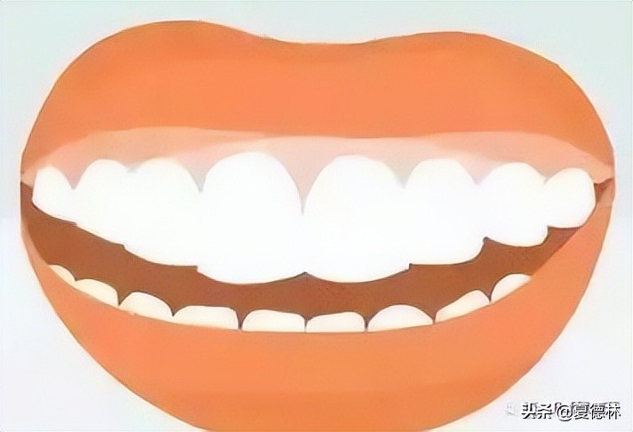 笑露牙龈怎么通过日常改善,为什么有些人笑起来露牙龈