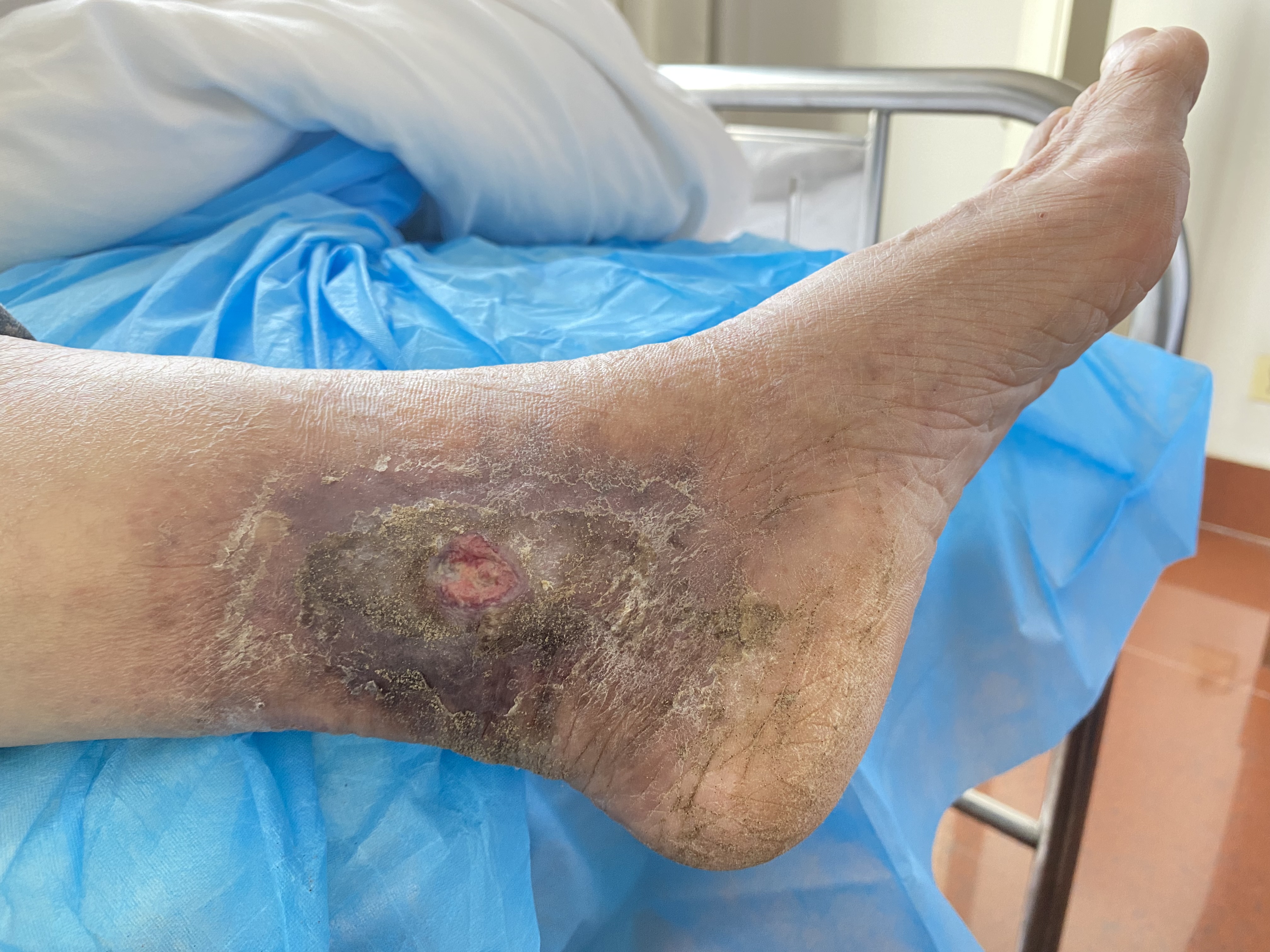 打赢持久战,打赢歼灭战打好持久战