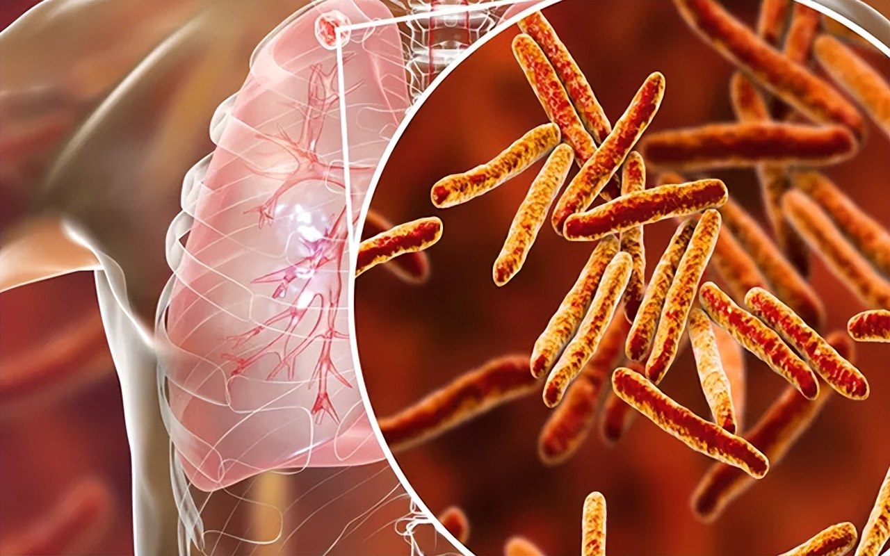 紫癜好了之后总是出针尖样小点,紫癜恢复期有针尖出血点