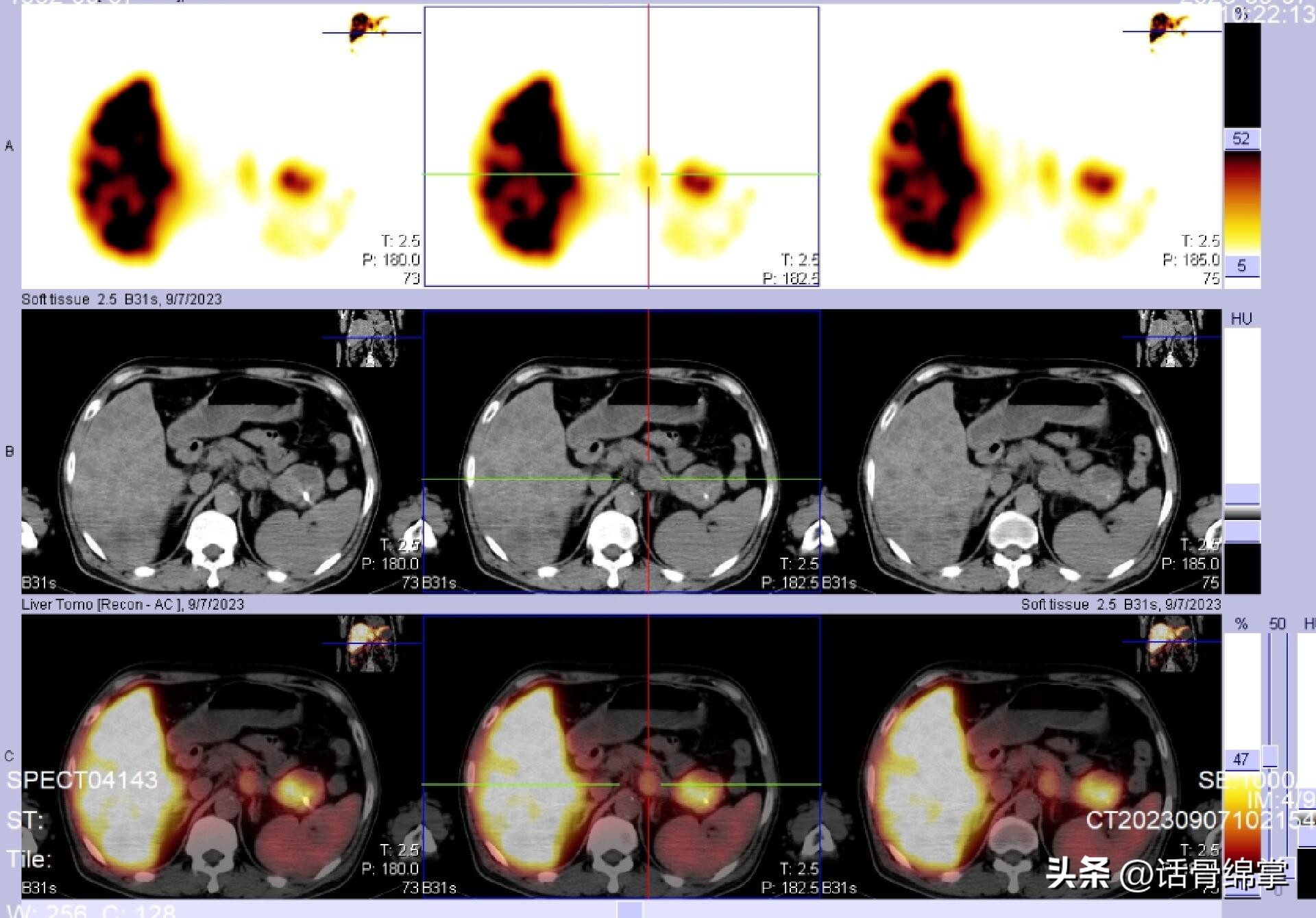 核医学四川省,绵阳金家林核医学中心最新消息
