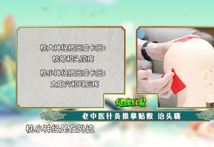 针灸哪些穴位可以有效缓解偏头疼,怎样治疗头痛最快最有效